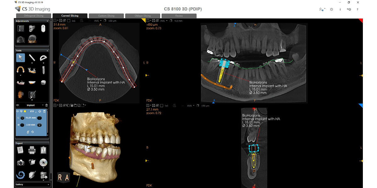 CS PDIP | Imaging Solutions